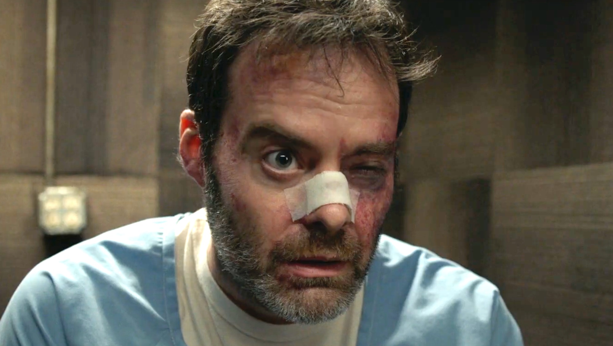 Barry Berkman (Bill Hader) in a grey room after being beaten up, with a bandage over his nose and his left eye swollen shut